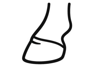 Hoof Health